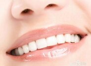 牙齿矫正让自信笑容挂脸上